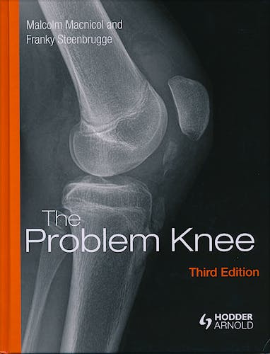 Portada del libro 9781444120110 The Problem Knee