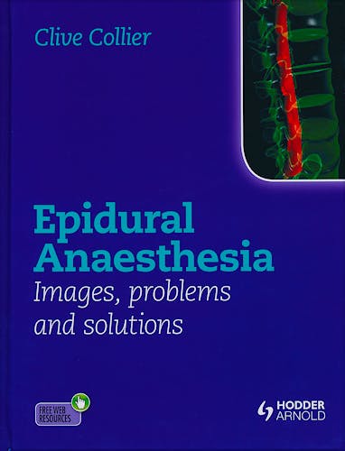 Portada del libro 9781444156041 Epidural Anaesthesia. Images, Problems and Solutions
