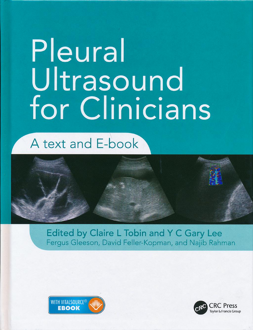 Portada del libro 9781444166958 Pleural Ultrasound for Clinicians