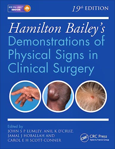 Portada del libro 9781444169188 Hamilton Bailey's Demonstrations of Physical Signs in Clinical Surgery