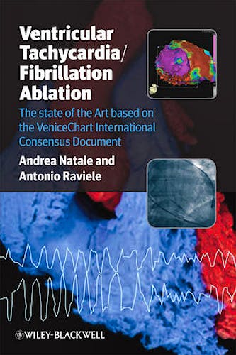 Portada del libro 9781444330731 Ventricular Tachycardia / Fibrillation Ablation. the State of the Art Based on the Venicechart International Consensus Document