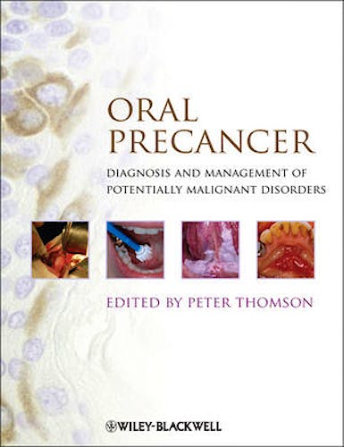 Portada del libro 9781444335743 Oral Precancer. Diagnosis and Management of Potentially Malignant Disorders
