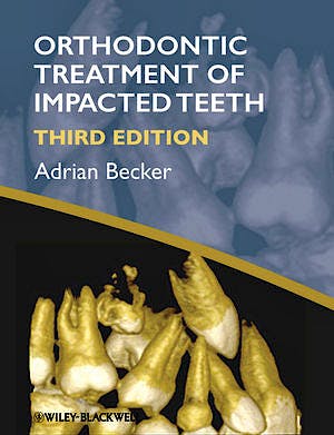Portada del libro 9781444336757 Orthodontic Treatment of Impacted Teeth