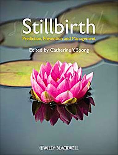 Portada del libro 9781444337068 Stillbirth. Prediction, Prevention and Management