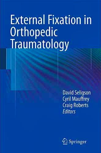 Portada del libro 9781447121992 External Fixation in Orthopedic Traumatology
