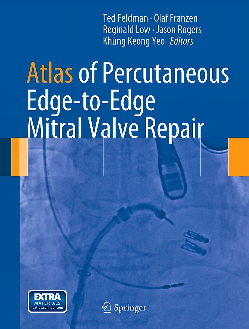 Portada del libro 9781447142935 Atlas of Percutaneous Edge-to-Edge Mitral Valve Repair