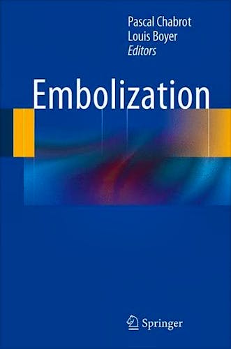 Portada del libro 9781447151814 Embolization
