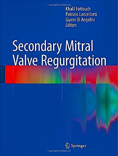 Portada del libro 9781447164876 Secondary Mitral Valve Regurgitation