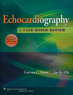 Portada del libro 9781451109610 Echocardiography: A Case-Based Review
