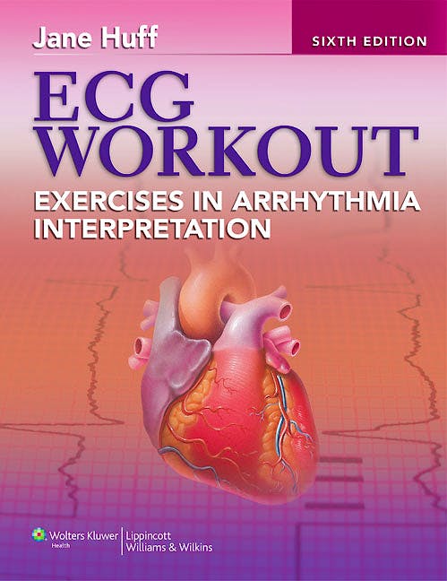 Portada del libro 9781451115536 Ecg Workout, Exercises in Arrhythmia Interpretation