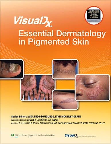 Portada del libro 9781451116052 Visualdx: Essential Dermatology in Pigmented Skin