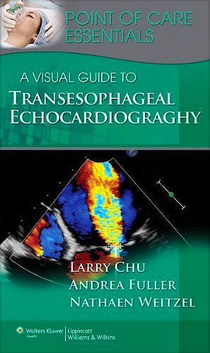 Portada del libro 9781451127881 A Visual Guide to Transesophageal Echocardiography (Point of Care Essentials