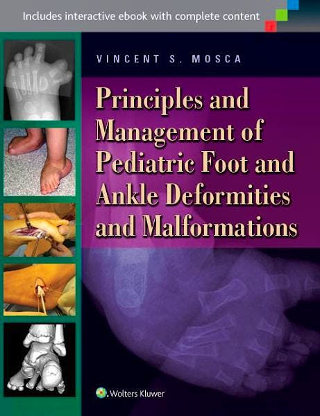 Portada del libro 9781451130454 Principles and Management of Pediatric Foot and Ankle Deformities and Malformations