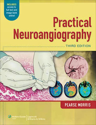 Portada del libro 9781451144154 Practical Neuroangiography (Online and Print)