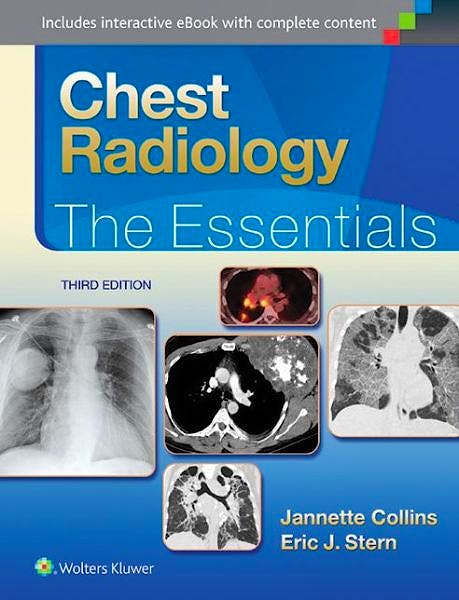 Portada del libro 9781451144482 Chest Radiology. the Essentials
