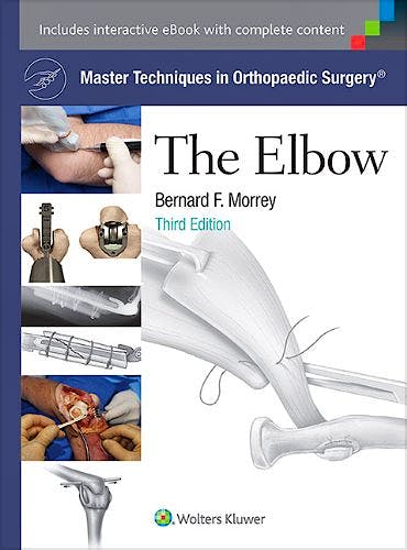Portada del libro 9781451173093 Master Techniques in Orthopaedic Surgery. the Elbow