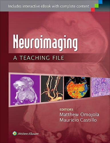 Portada del libro 9781451173284 Neuroimaging. a Teaching File