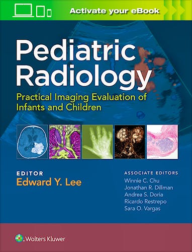 Portada del libro 9781451175851 Pediatric Radiology. Practical Imaging Evaluation of Infants and Children
