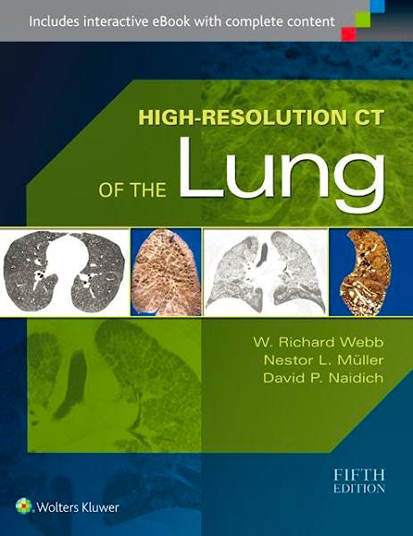 Portada del libro 9781451176018 High-Resolution Ct of the Lung