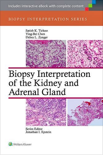 Portada del libro 9781451176476 Biopsy Interpretation of the Kidney and Adrenal Gland