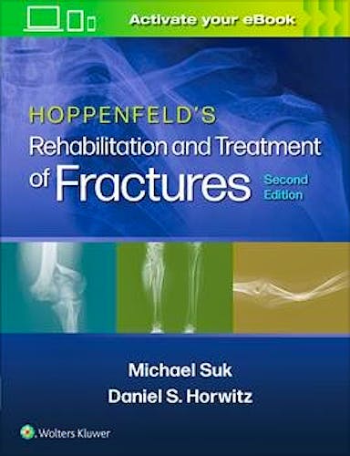 Portada del libro 9781451185683 HOPPENFELD's Rehabilitation and Treatment of Fractures