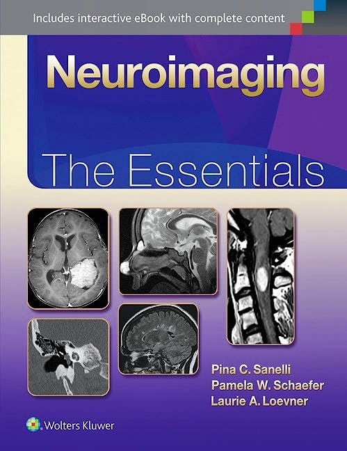Portada del libro 9781451191356 Neuroimaging. the Essentials