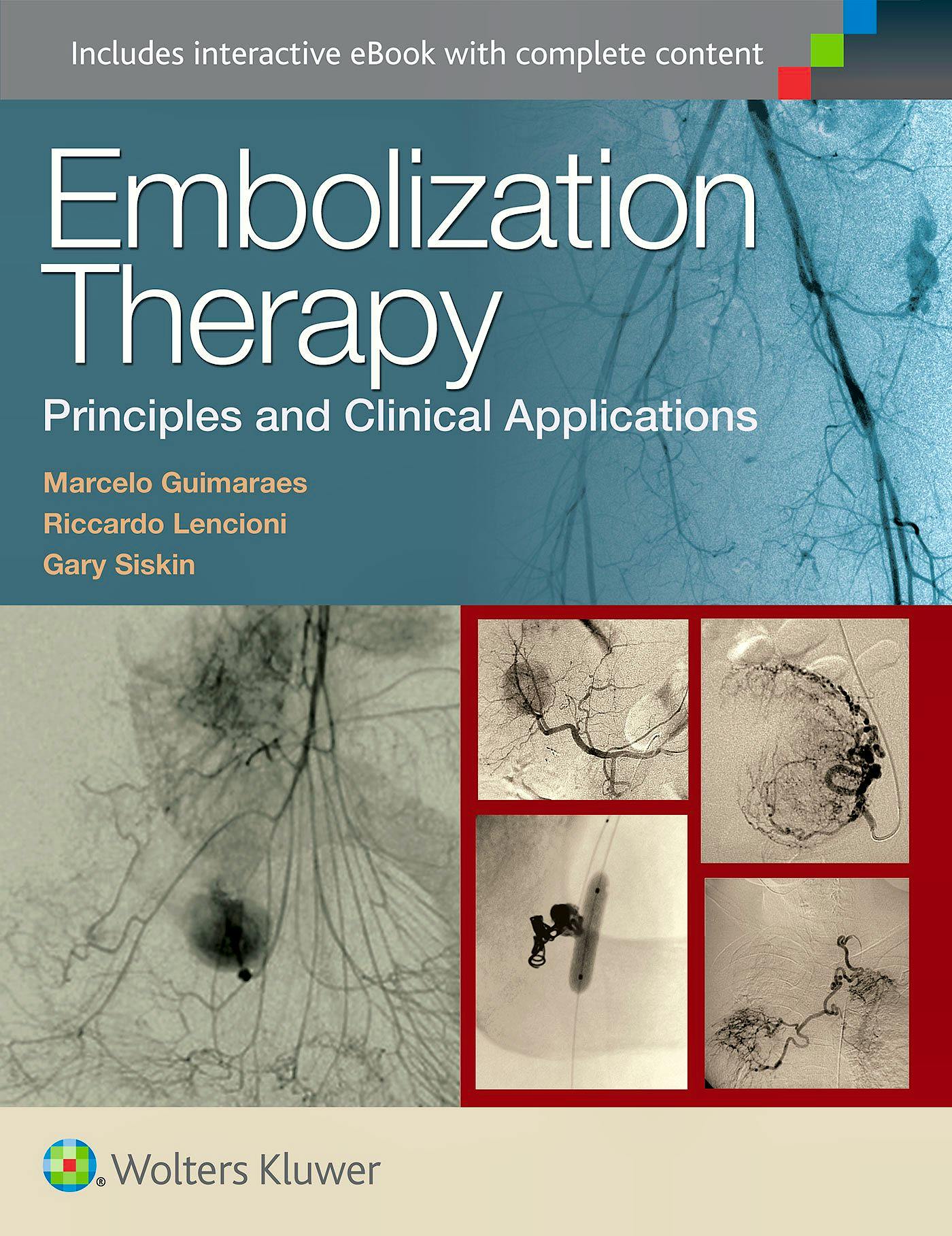 Postpartum Hemorrhage Clinical Applications Embolizat - vrogue.co