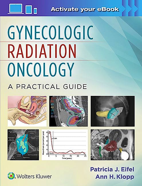 Portada del libro 9781451192650 Gynecologic Radiation Oncology. a Practical Guide (Print and Online)