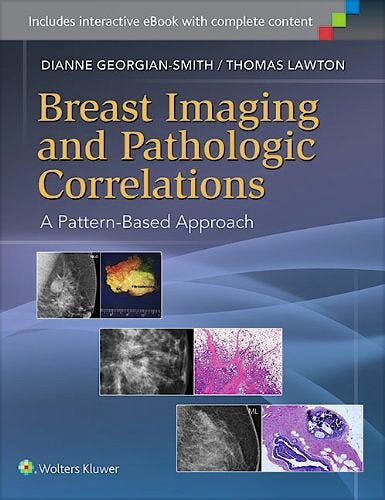 Portada del libro 9781451192698 Breast Imaging and Pathologic Correlations. a Pattern-Based Approach (Online and Print)