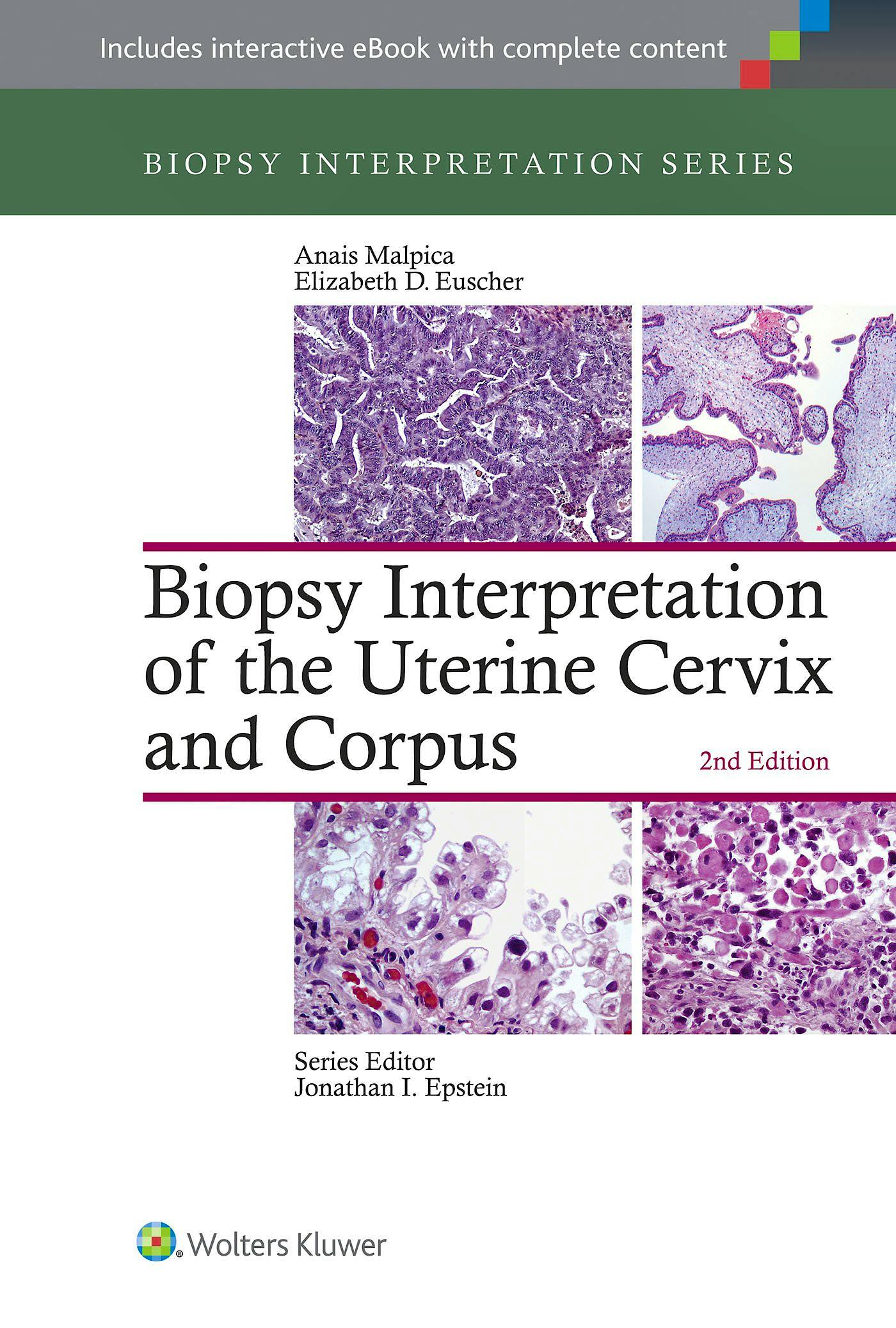 Portada del libro 9781451192964 Biopsy Interpretation of the Uterine Cervix and Corpus