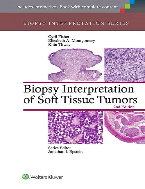 Portada del libro 9781451192995 Biopsy Interpretation of Soft Tissue Tumors