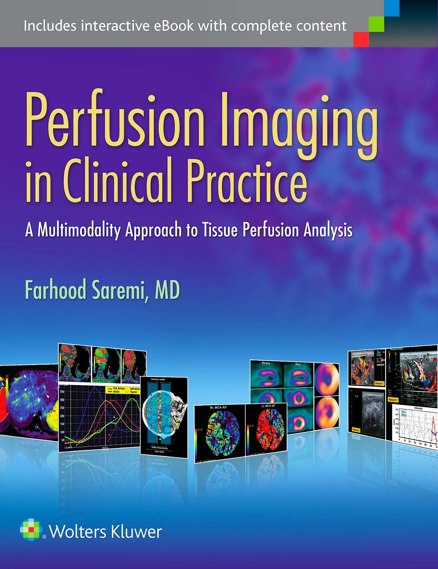 Portada del libro 9781451193169 Perfusion Imaging in Clinical Practice. a Multimodality Approach to Tissue Perfusion Analysis