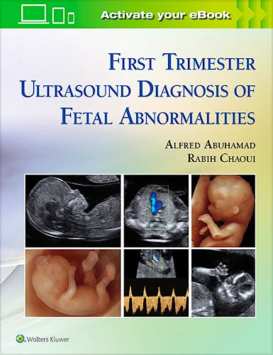 Portada del libro 9781451193725 First Trimester Ultrasound of Fetal Abnormalities