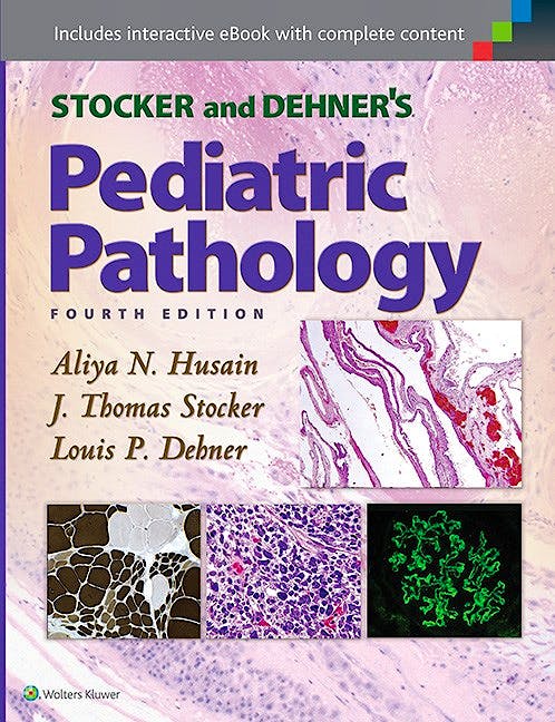 Portada del libro 9781451193732 Stocker and Dehner's Pediatric Pathology
