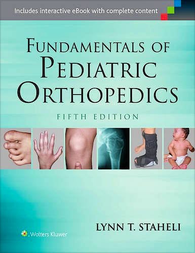 Portada del libro 9781451193930 Fundamentals of Pediatric Orthopedics