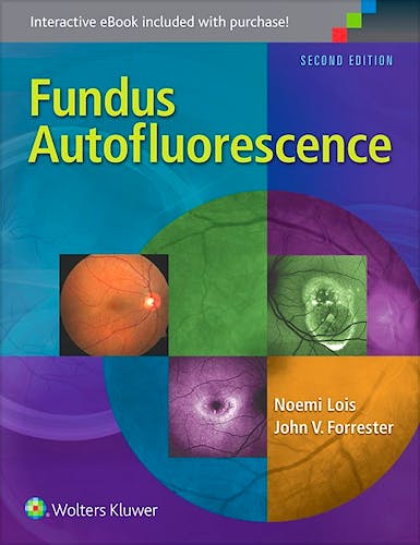 Portada del libro 9781451194593 Fundus Autofluorescence