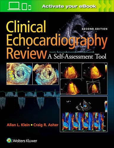 Portada del libro 9781451195378 Clinical Echocardiography Review. a Self-Assessment Tool