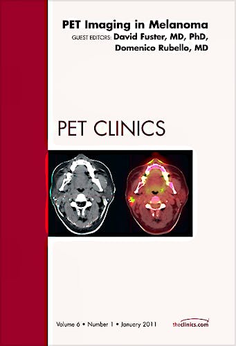Portada del libro 9781455704682 Clinical Applications of Diffusion Imaging of the Brain, an Issue of Neuroimaging Clinics, Volume 21-1