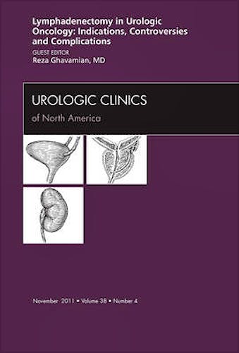 Portada del libro 9781455710485 Lyphadenctomy in Urologic Oncology: Indications, Controversies, and Complications, an Issue of Urologic Clinics, Vol. 38-4
