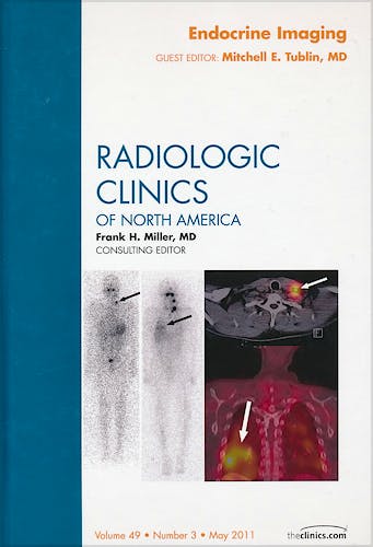 Portada del libro 9781455711499 Endocrine Imaging. An Issue of Radiologic Clinics