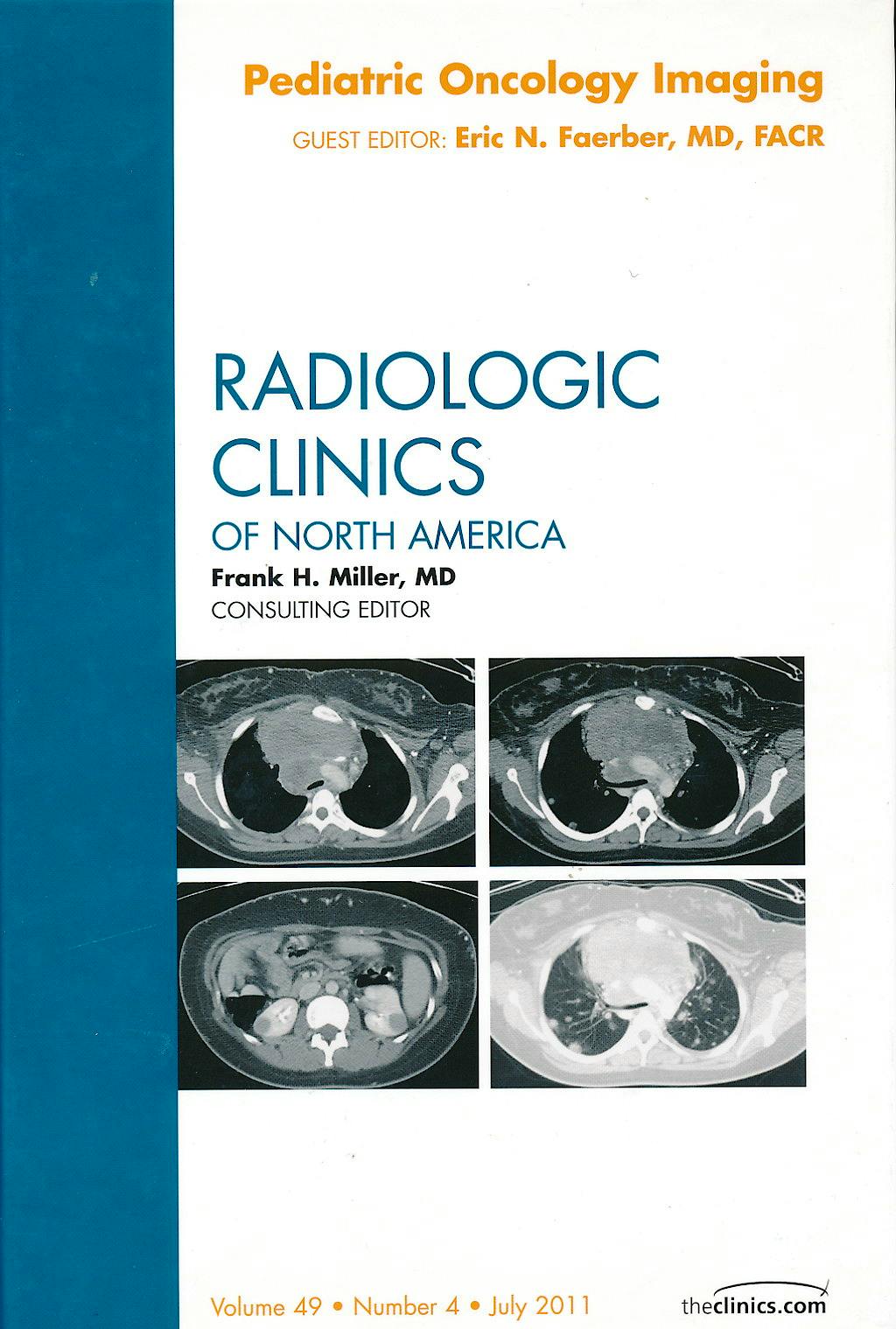 Portada del libro 9781455711505 Pediatric Oncology Imaging (An Issue of Radiologic Clinics of North America)