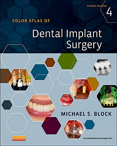 Portada del libro 9781455759682 Color Atlas of Dental Implant Surgery