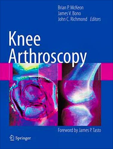 Portada del libro 9781461410553 Knee Arthroscopy