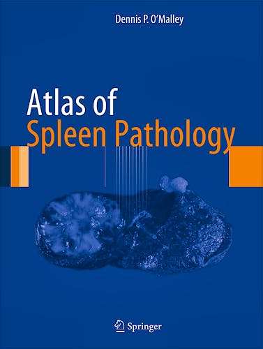 Portada del libro 9781461446712 Atlas of Spleen Pathology (Atlas of Anatomic Pathology)