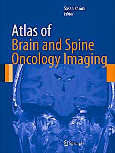 Portada del libro 9781461456520 Atlas of Brain and Spine Oncology Imaging