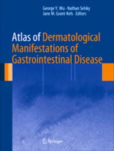 Portada del libro 9781461461906 Atlas of Dermatological Manifestations of Gastrointestinal Disease