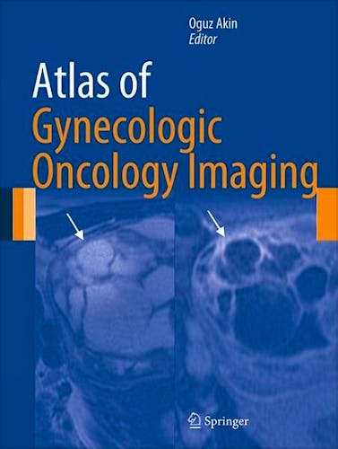 Portada del libro 9781461472117 Atlas of Gynecologic Oncology Imaging