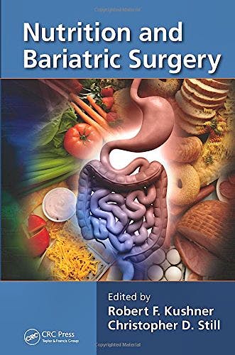 Portada del libro 9781466557697 Nutrition and Bariatric Surgery