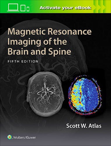 Portada del libro 9781469873206 Magnetic Resonance Imaging of the Brain and Spine