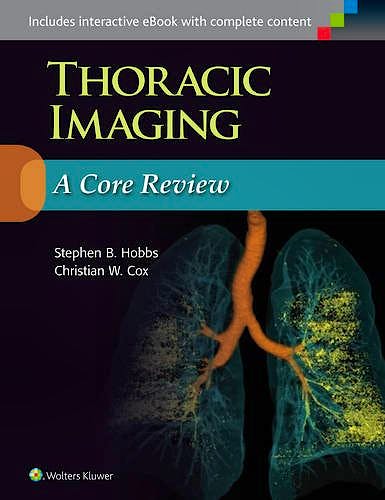 Portada del libro 9781469898834 Thoracic Imaging. a Core Review